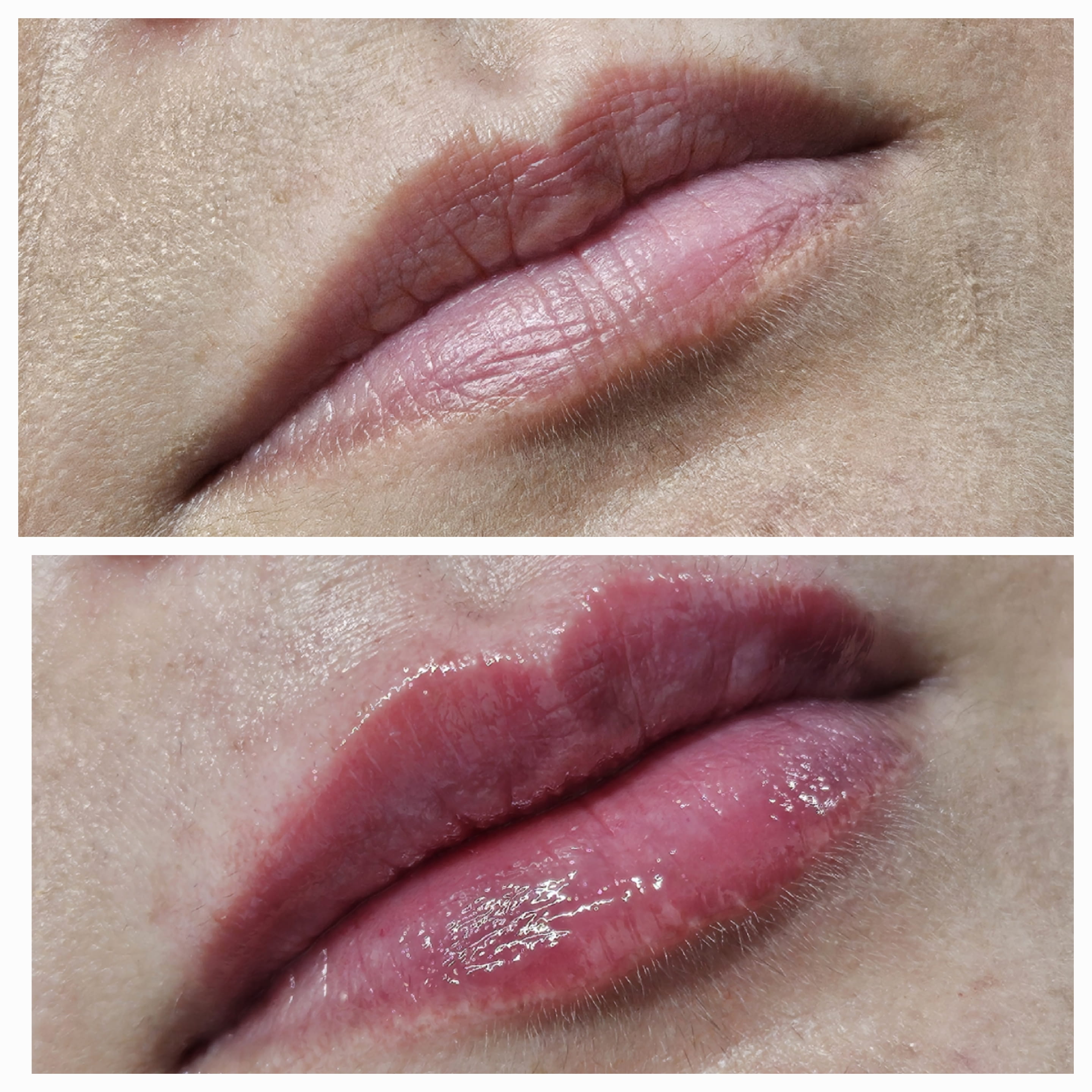 Lip Mariya Aesthetics Nottingham