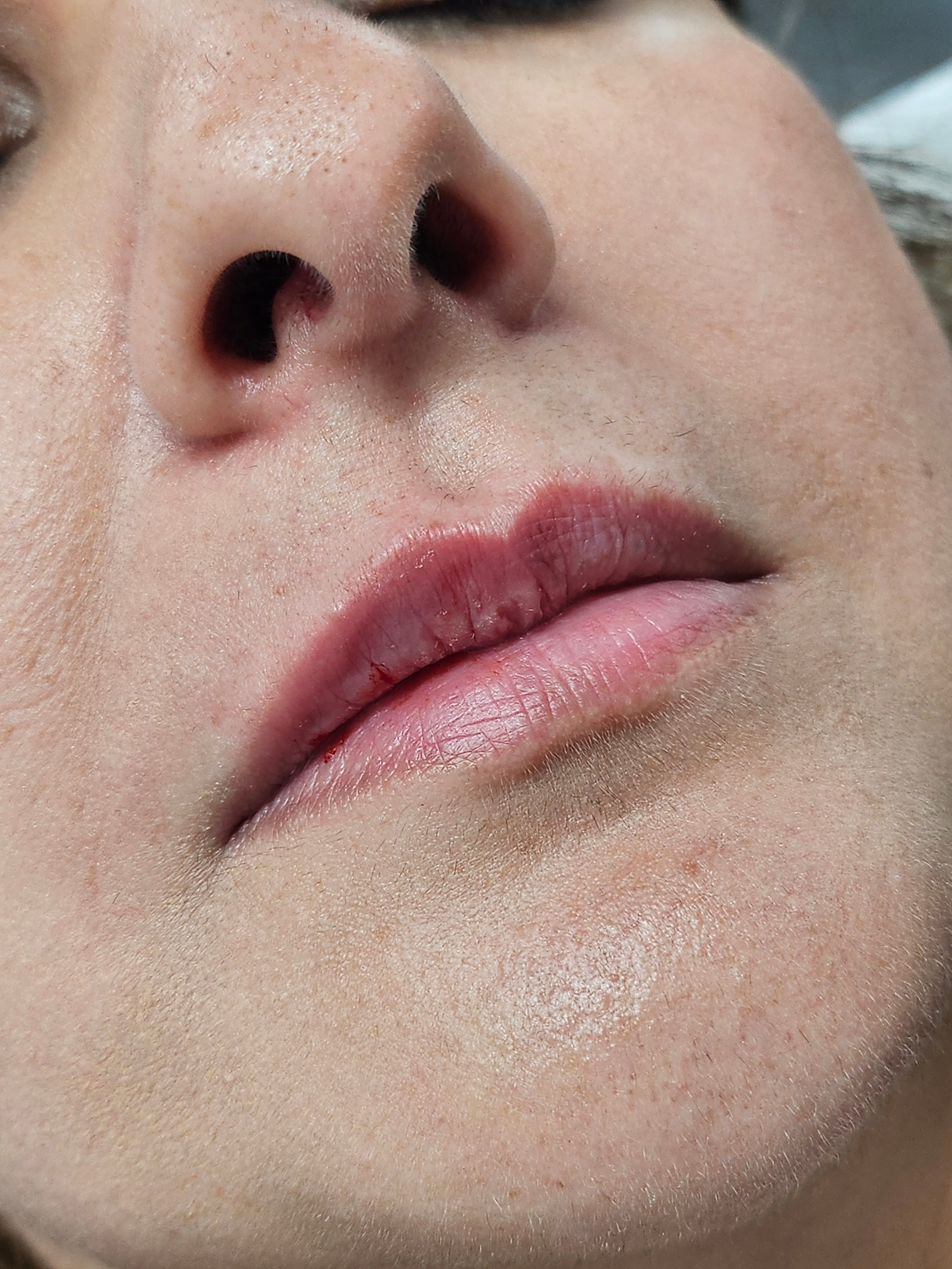 Lip Mariya Aesthetics Nottingham