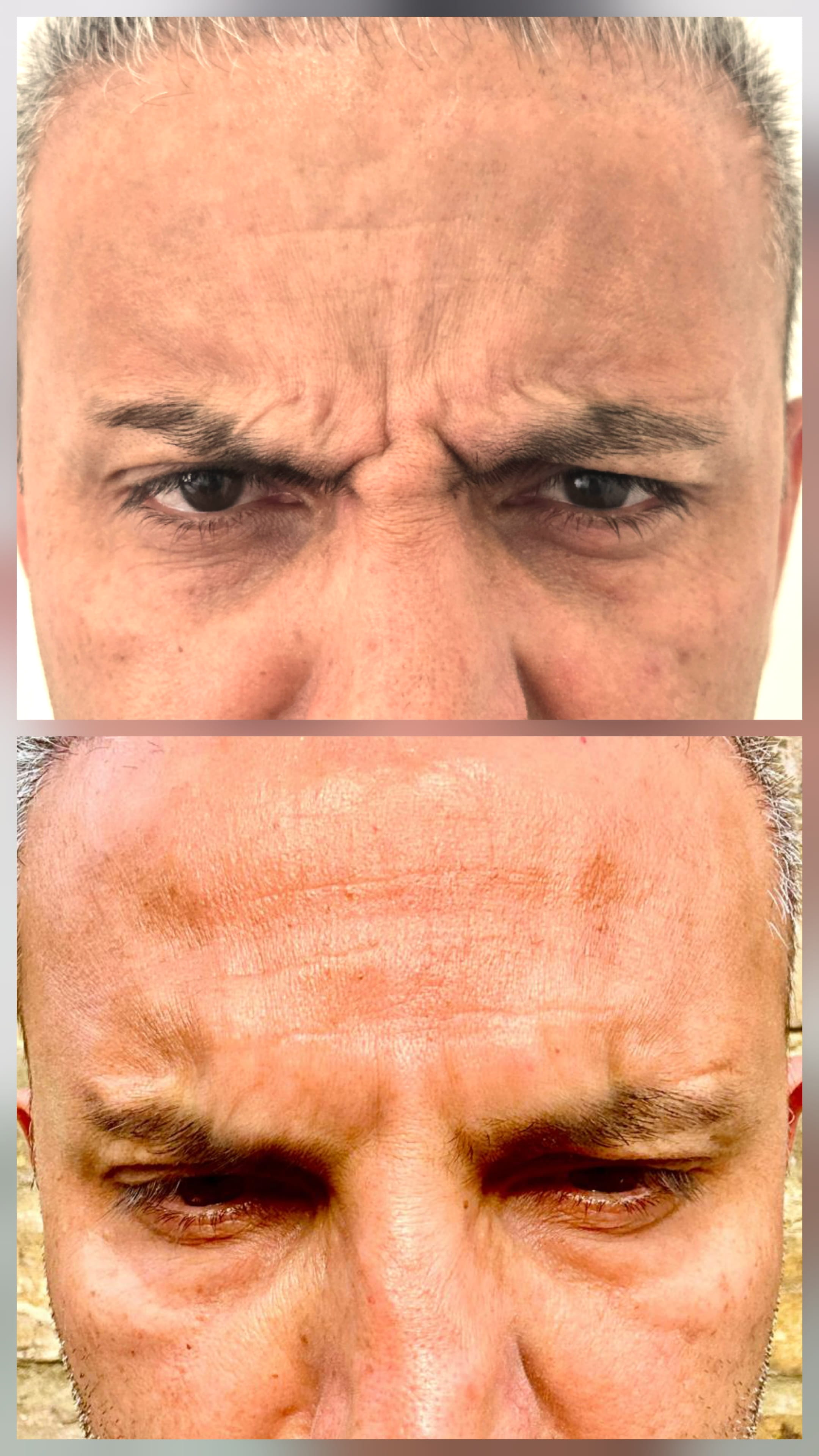 Tox Mariya Aesthetics Nottingham