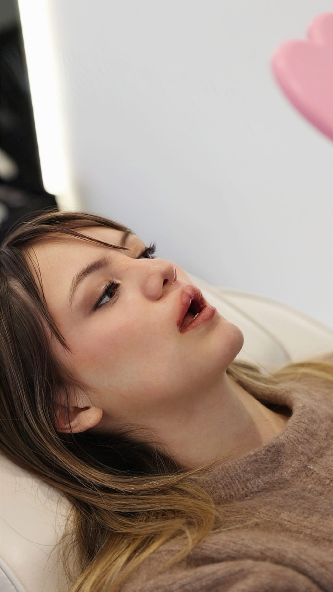 Cleft Lip Mariya Aesthetics Nottingham