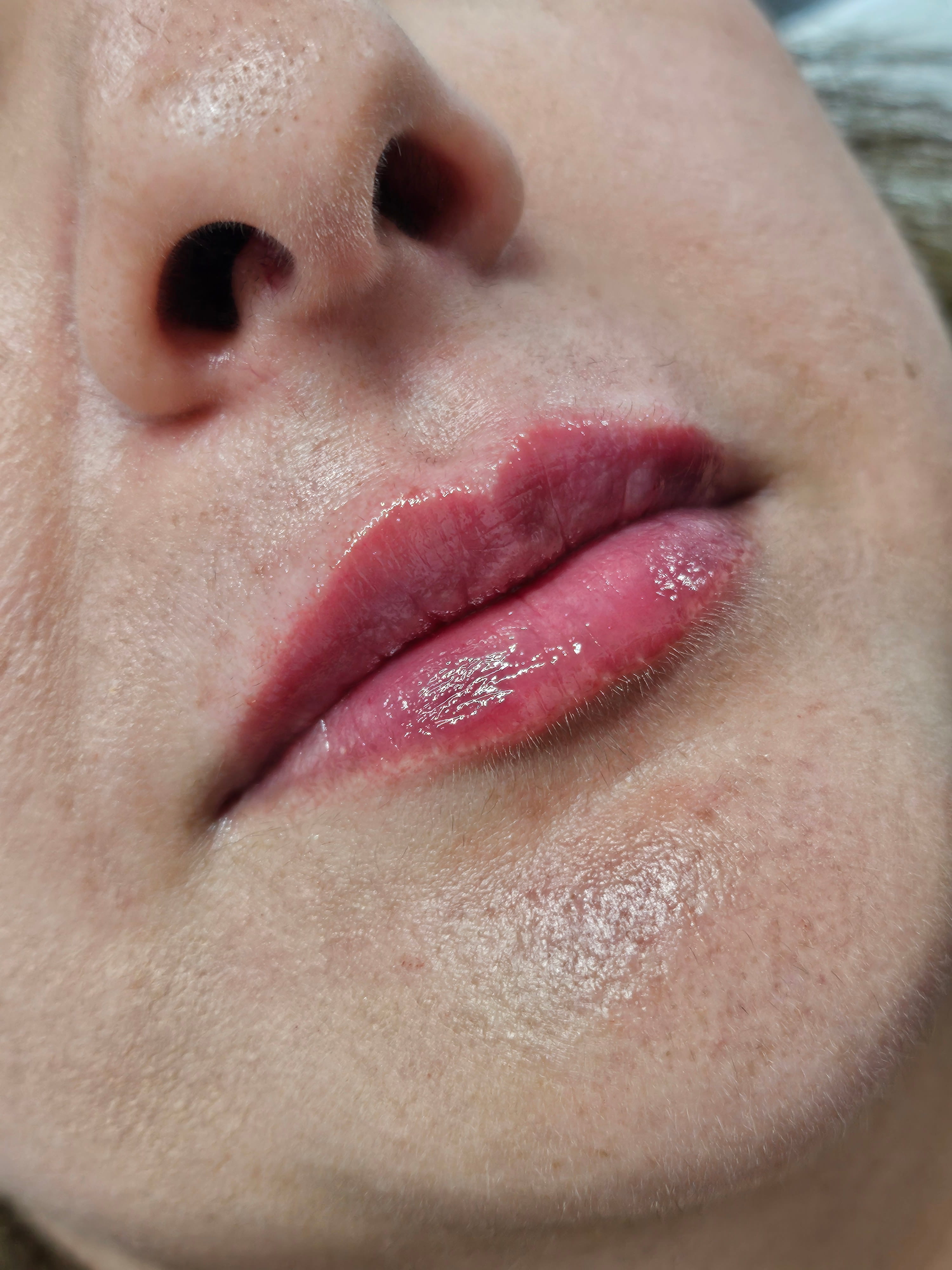 Lip Mariya Aesthetics Nottingham