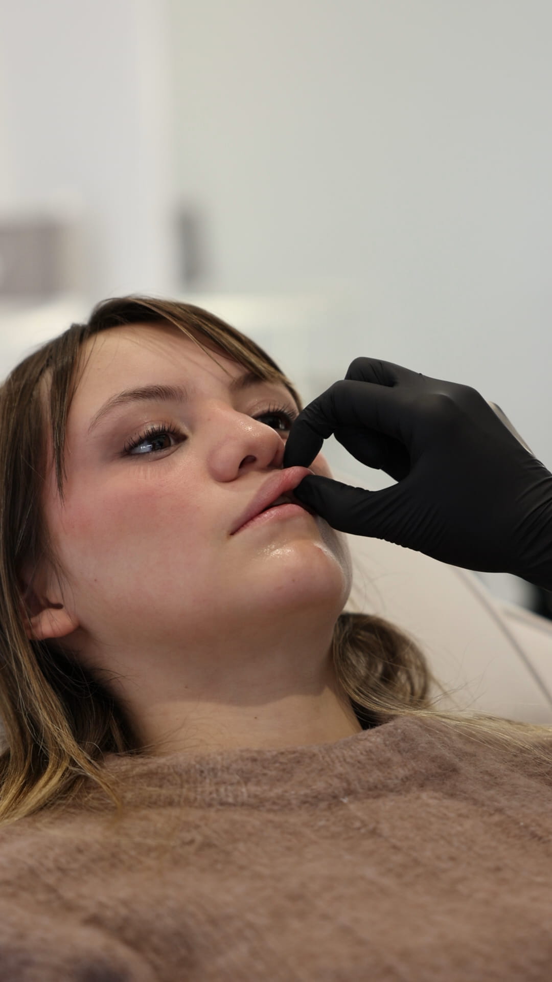 Cleft Lip Mariya Aesthetics Nottingham