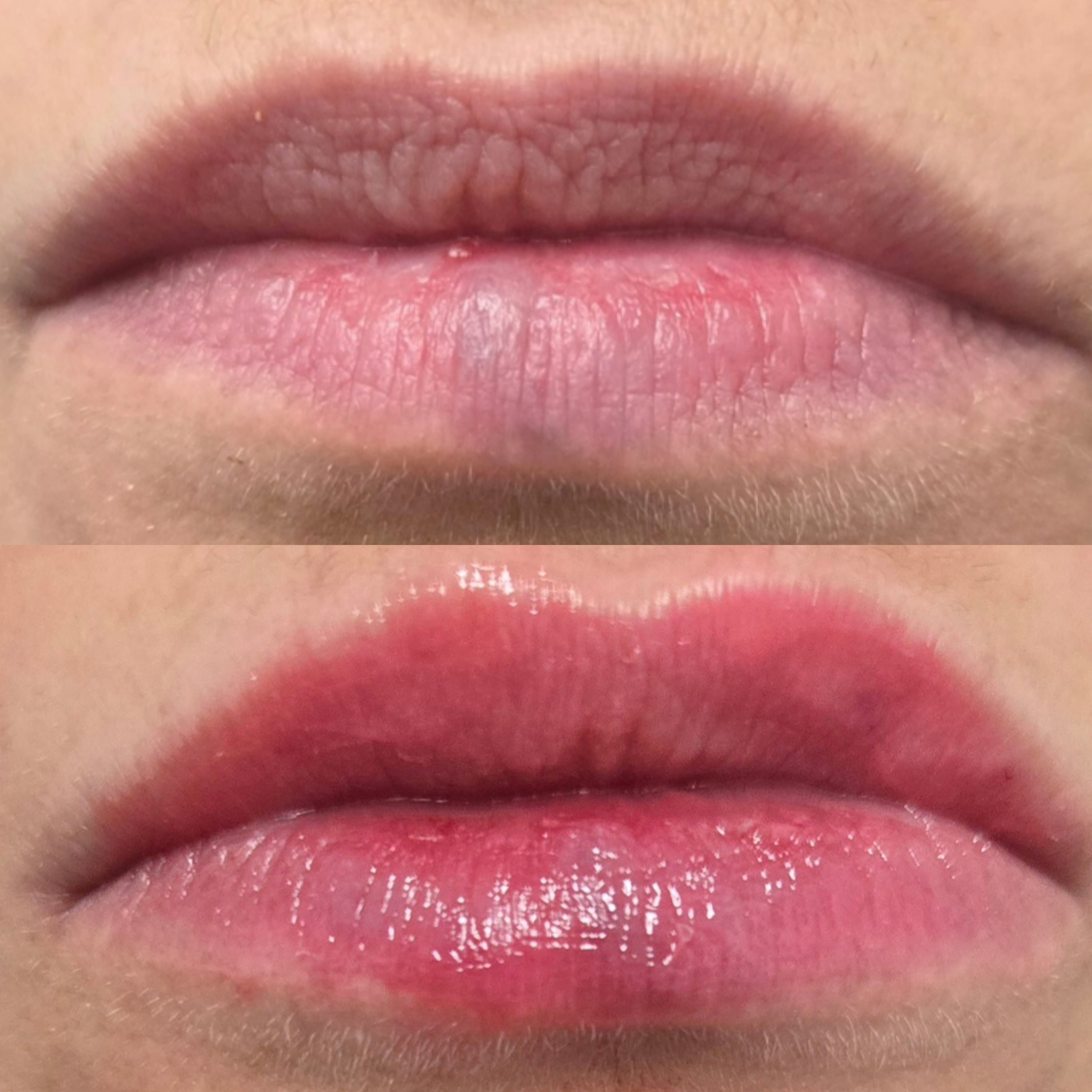 Lip Mariya Aesthetics Nottingham