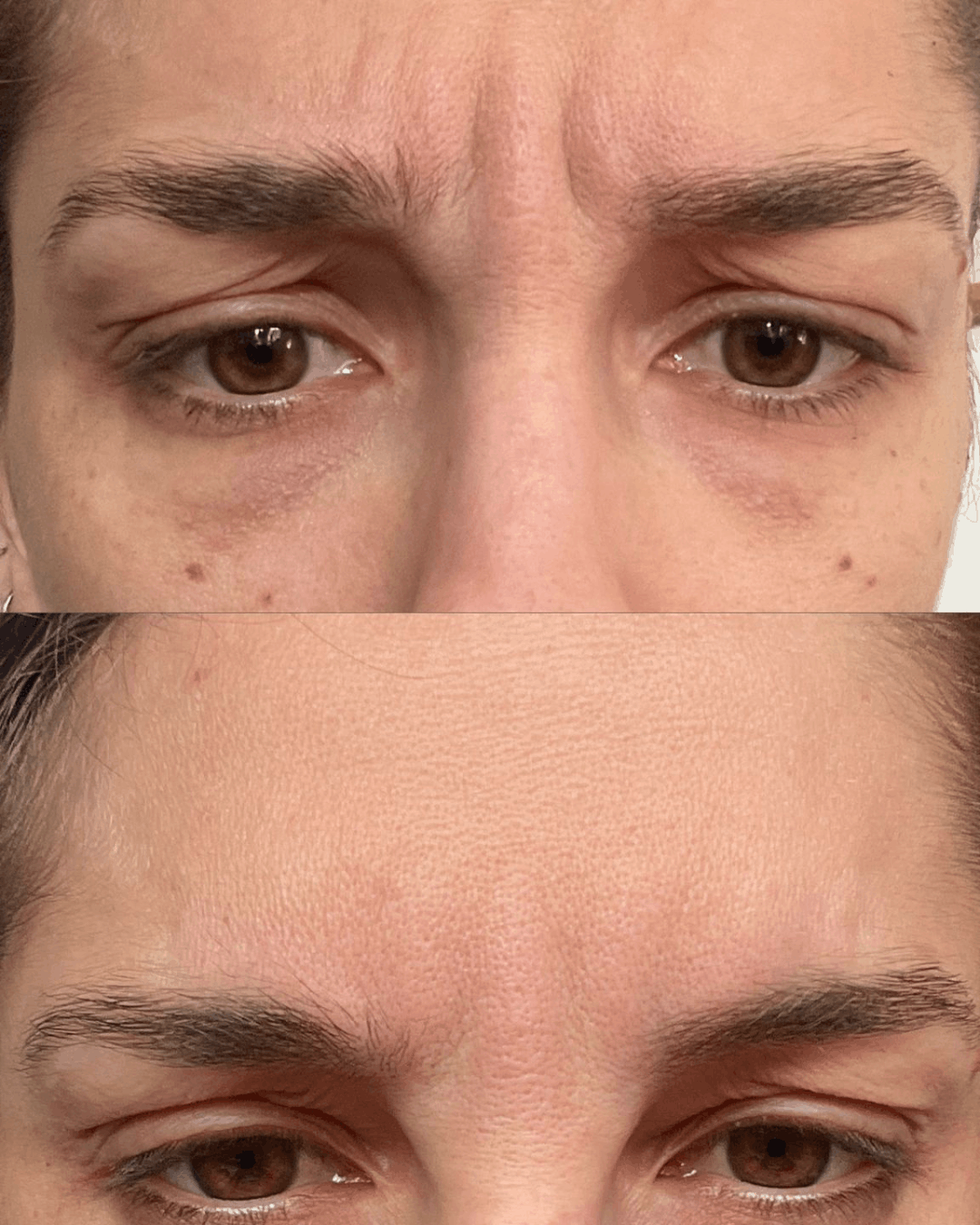 Tox Mariya Aesthetics Nottingham