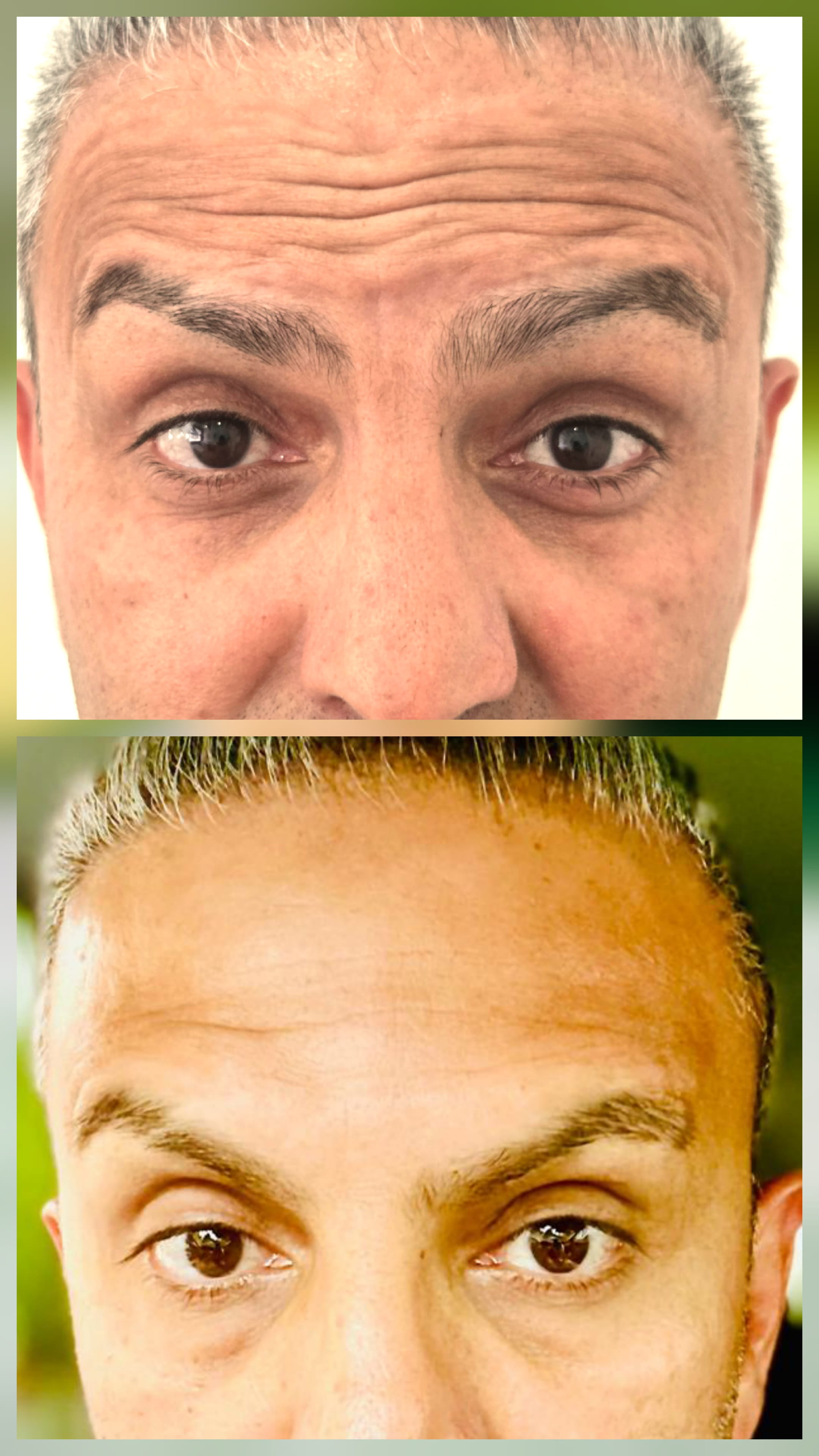 Tox Mariya Aesthetics Nottingham