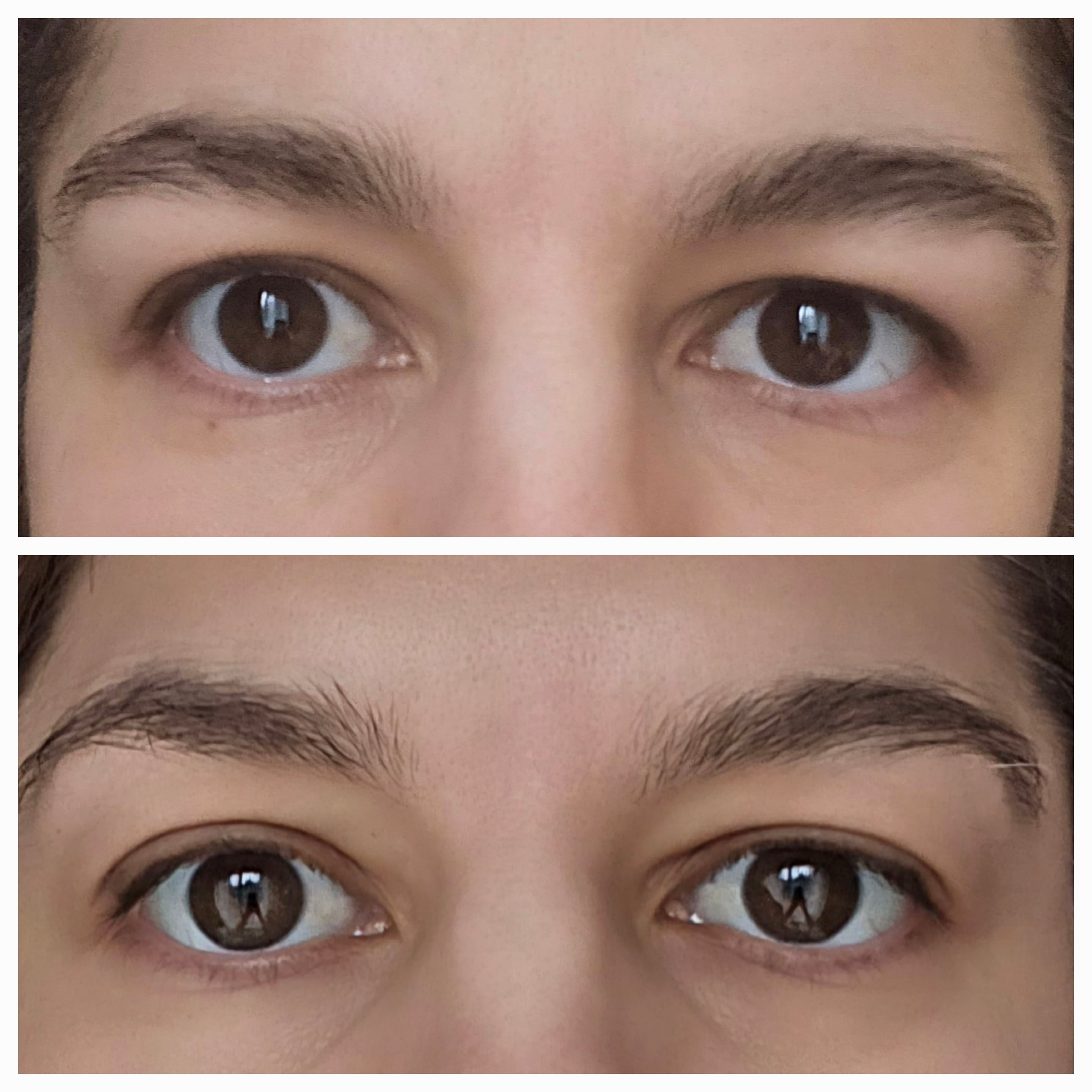Tox Mariya Aesthetics Nottingham